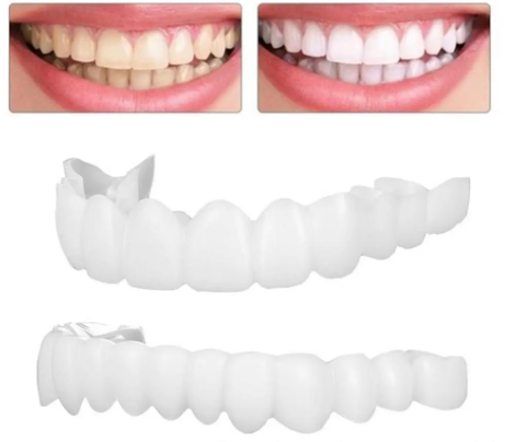 Carillas Dentales Completas - Superior e Inferior